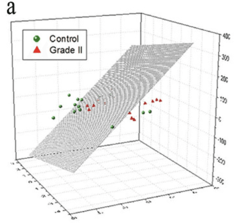 Publication image for Autoantibody profiling of glioma serum samples to identify biomarkers using human proteome arrays