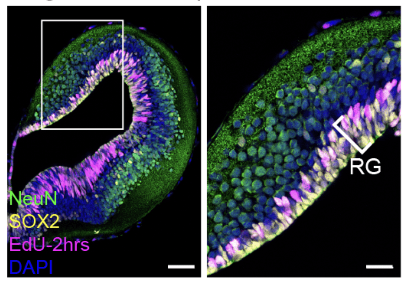 Publication image for A conserved logic for the development of cortical layering in tetrapods